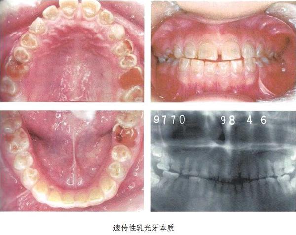 西寧牙齒矯正